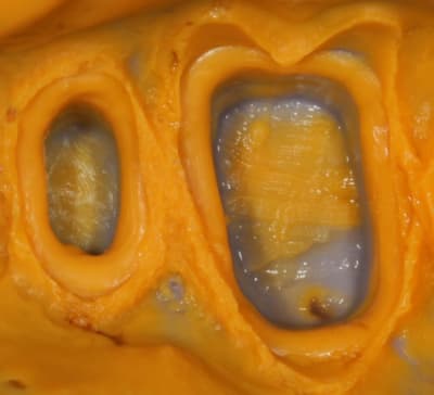 Img 4301 erf57v - Eugenol