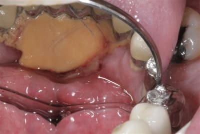 Img 4621 kecrwy - Eugenol