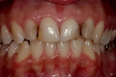 Img 4652  custom  uixck8 - Eugenol