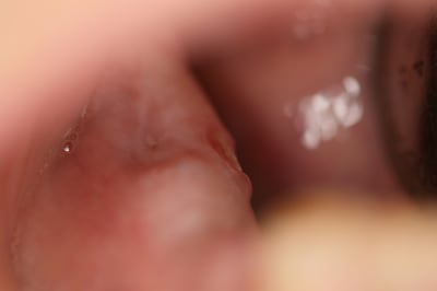 Img 4724 abn6yq - Eugenol