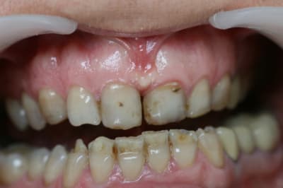 Img 4770 alqj1p - Eugenol