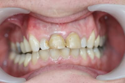 Img 4821 mbz3vm - Eugenol