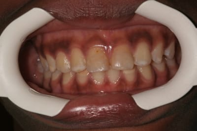 Img 4832 yorn8o - Eugenol