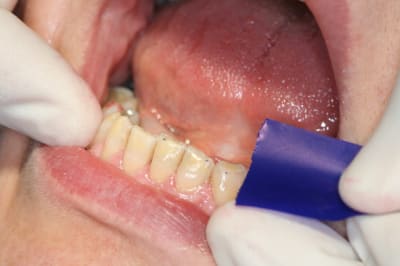 Img 5150 mxuaih - Eugenol