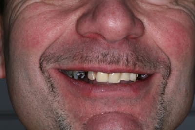 Img 5230 zlakyl - Eugenol