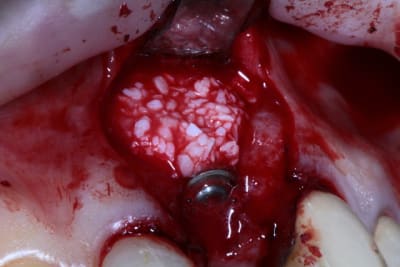 Img 5297 e9yptu - Eugenol