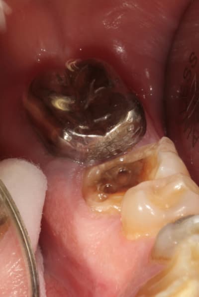 Img 5377 evgvkj - Eugenol