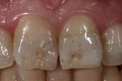 Img 5533  custom  ocnoyz - Eugenol