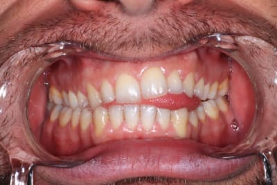 Img 5807 t0xnaf - Eugenol