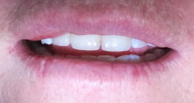 Img 5813 bhh1tm - Eugenol