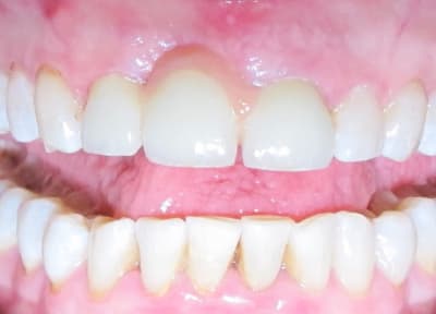 Img 5820 kowclt - Eugenol