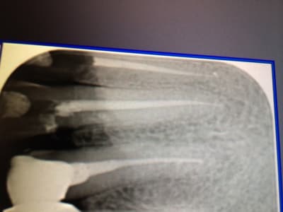 Img 6199 pw5dme - Eugenol