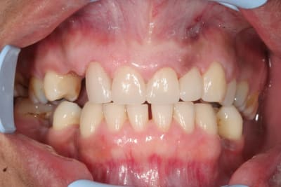 Img 6201 w1myos - Eugenol