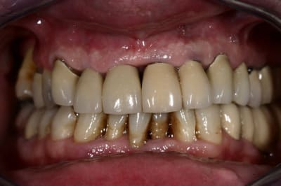 Img 6290 hjdzpw - Eugenol