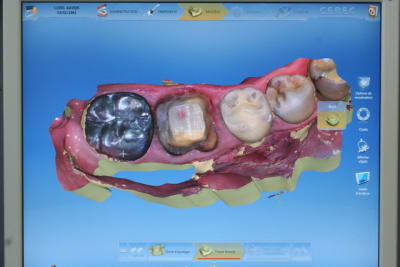 Img 6337 rbeieu - Eugenol