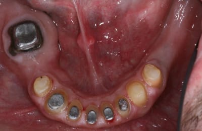 Img 6368 bnfdfj - Eugenol