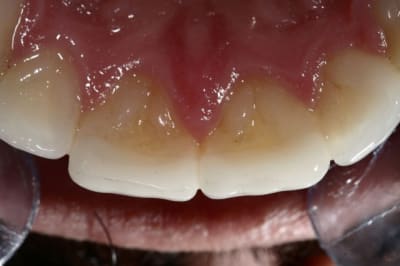Img 6477  1024x768  ywnopv - Eugenol