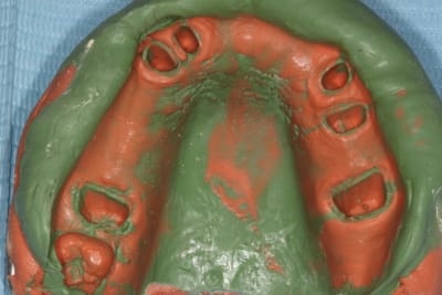 Img 6588 vlno7o - Eugenol