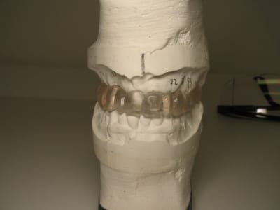 Img 6807 rimgm6 - Eugenol