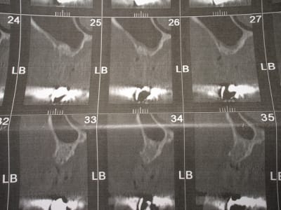 Img 6816 tmgfgv - Eugenol