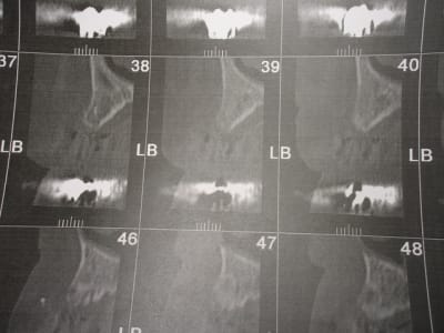 Img 6817 tptxce - Eugenol