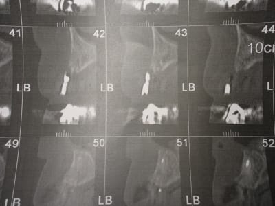 Img 6818 dbftcd - Eugenol