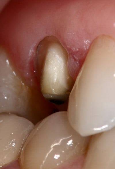 Img 6829 bo0t2o - Eugenol