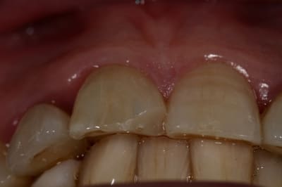 Img 7263 dnsk2b - Eugenol
