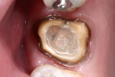 Img 7279 ll6yey - Eugenol