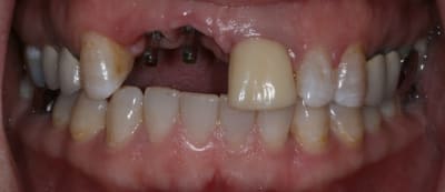 Img 7279 quqvfk - Eugenol