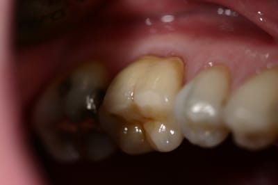 Img 7326 zdpgqd - Eugenol