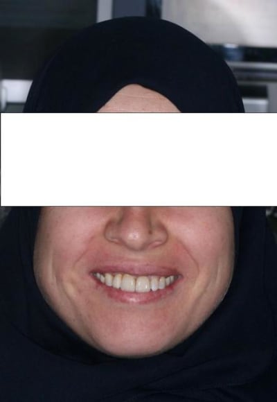 Img 76232 gqeyme - Eugenol