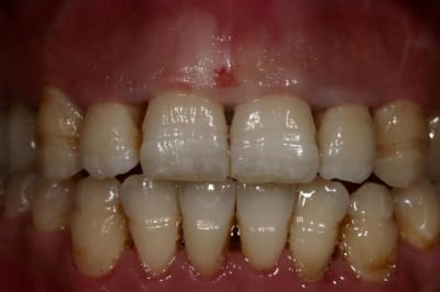Img 7732  custom  rmzmyq - Eugenol