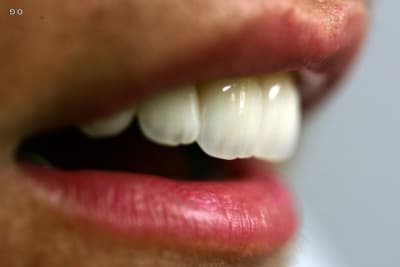 Img 7825 qugftf - Eugenol