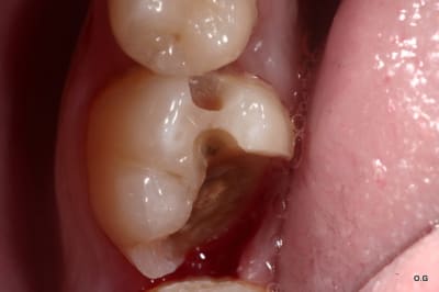 Img 7865 rjs3gn - Eugenol