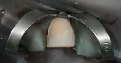 Img 8465 ou7opq - Eugenol