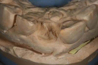 Img 8480 vw0hu8 - Eugenol