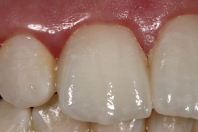 Img 8778 mdrqgl - Eugenol