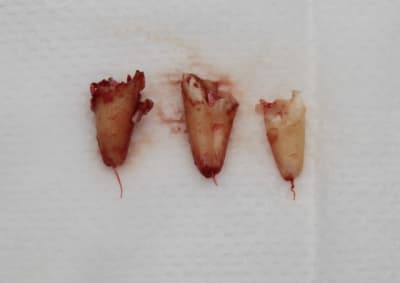 Img 8827 u00ko3 - Eugenol