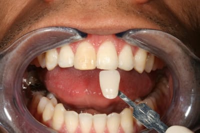 Img 9038 afjjes - Eugenol