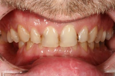 Img 9257 lz7zgv - Eugenol