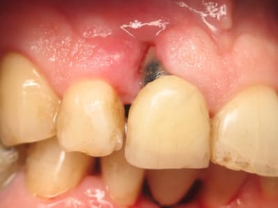 Img 9355 lx9xi3 - Eugenol