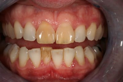 Img 9365 ofrvrx - Eugenol