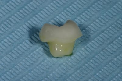 Img 9540 rm3dxz - Eugenol