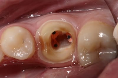 Img 9626 l5ihxu - Eugenol