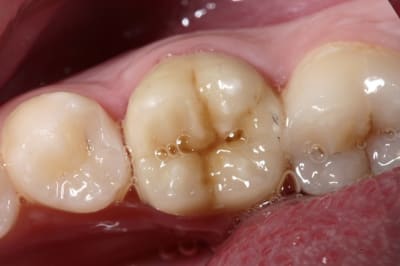 Img 9634 kqzqm9 - Eugenol