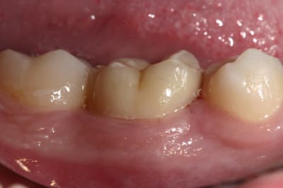 Img 9639 xuq6et - Eugenol