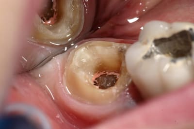 Img 9709 wngl2t - Eugenol