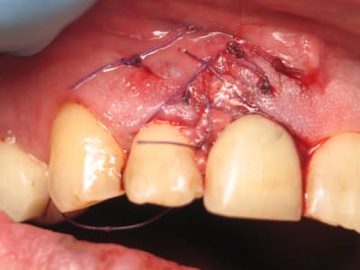 Img 9766 b795pd - Eugenol