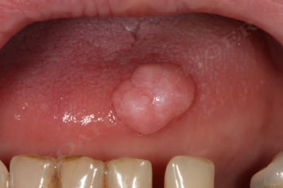 Img 9915 czfv9r - Eugenol